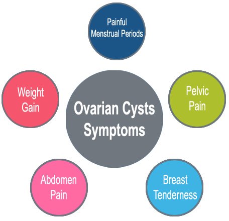 Ovarian Cysts Symptoms, Painful Menstrual Periods, Pelvic Pain, Breast Tenderness, Abdomen Pain, Weight Gain