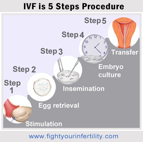 IVF procedure, ivf procedure step by step, ivf process, ivf stimulation fertility drugs, ivf egg retrieval procedure, ivf insemination process, ivf embryo culture, ivf transfer