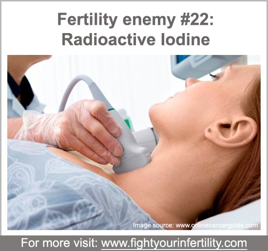 radioactive iodine fertility, does radioactive iodine affect fertility, dangers of radioactive iodine treatment, risks of radioactive iodine