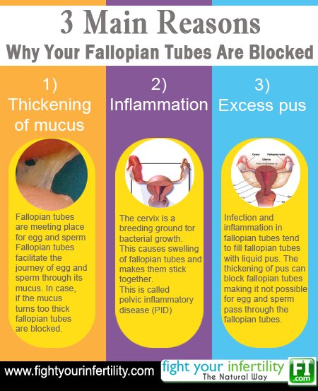 Blocked Fallopian Tubes Reasons, Open Blocked Fallopian Tubes Naturally, Thickening of mucus, Inflammation, Excess pus