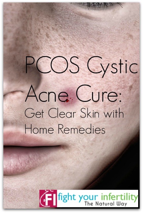 Anti Inflammatory Diet For Cystic Acne