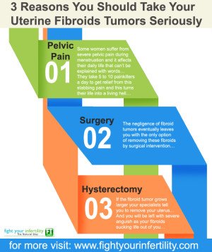 3 Reasons You Should Take Your Uterine Fibroids Tumors Seriously